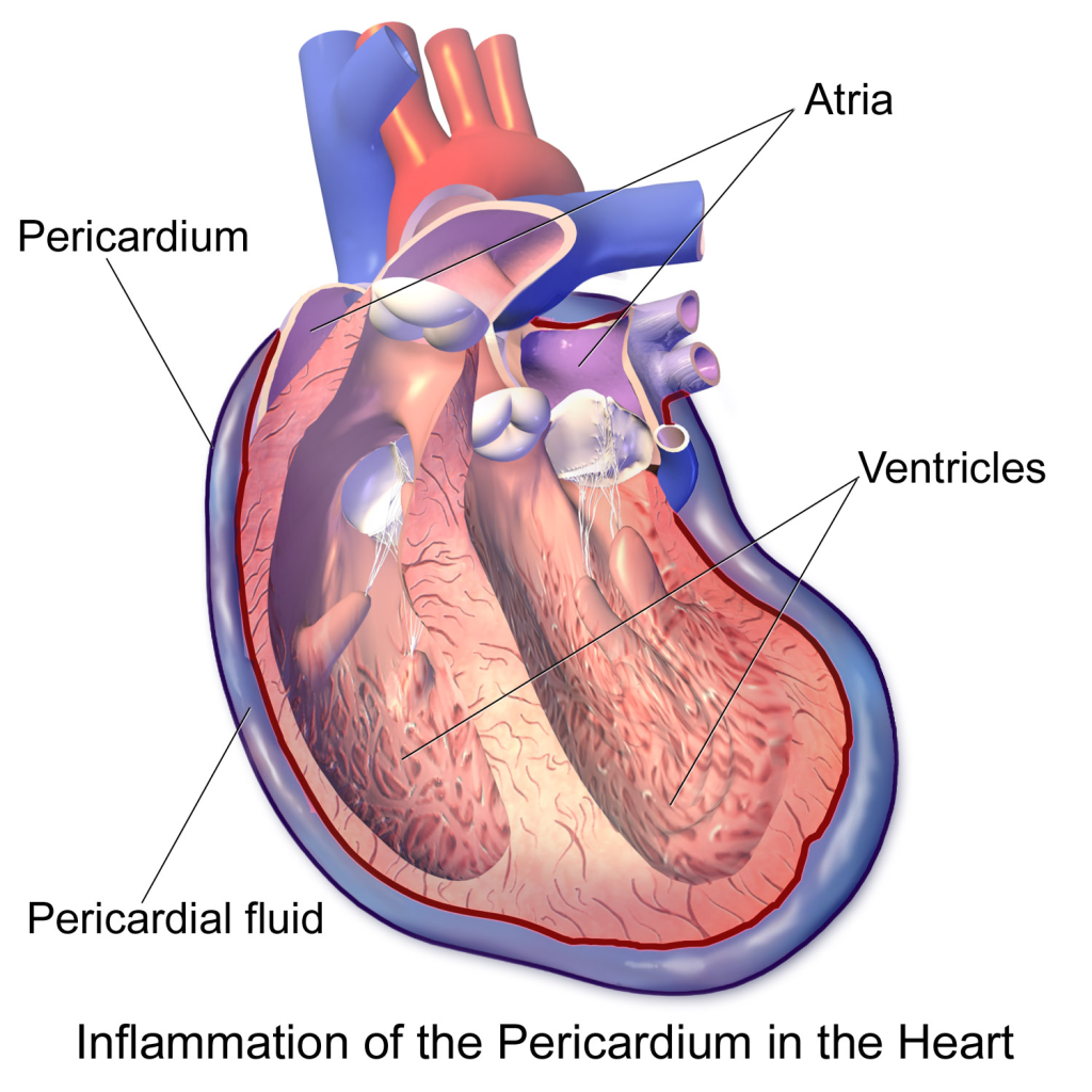 Symptoms, Diagnosis, Treatment, and Prognosis –...